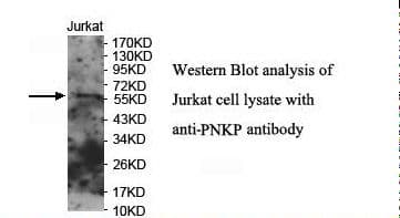 Polyclonal Rabbit anti-Human PNKP Antibody (aa253-418, IHC, WB)