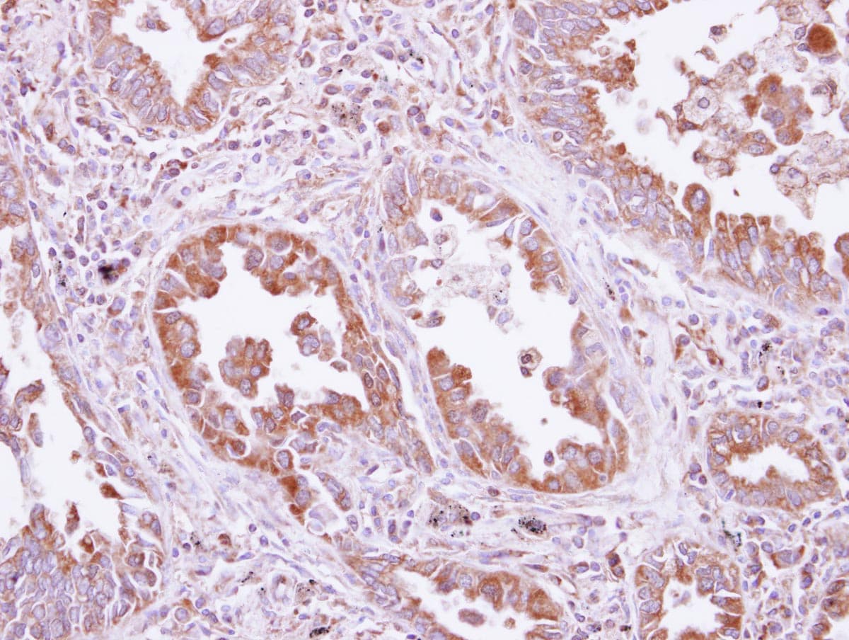 DARS Antibody
