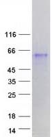 Human FAM90A9 Protein (Recombinant Myc-DDK (Flag))