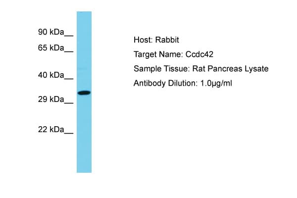 CCDC42 Antibody (aa161-210)