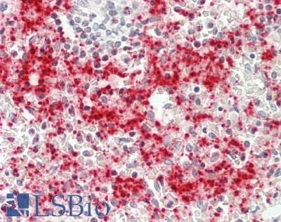 PathPlus™ F13A1 / Factor XIIIa Antibody (clone 1H2)