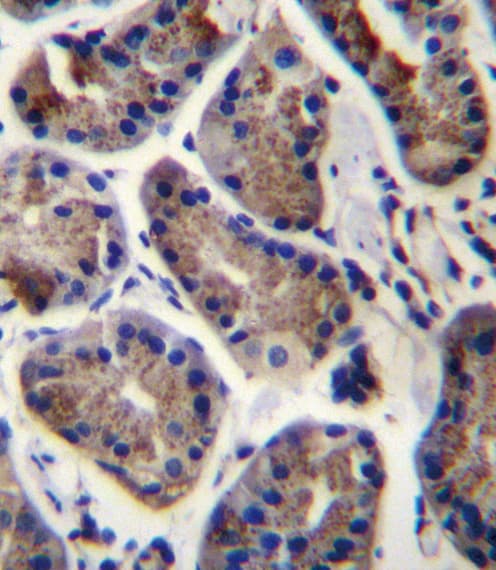 SLC9A2 / NHE2 Antibody (aa754-783)