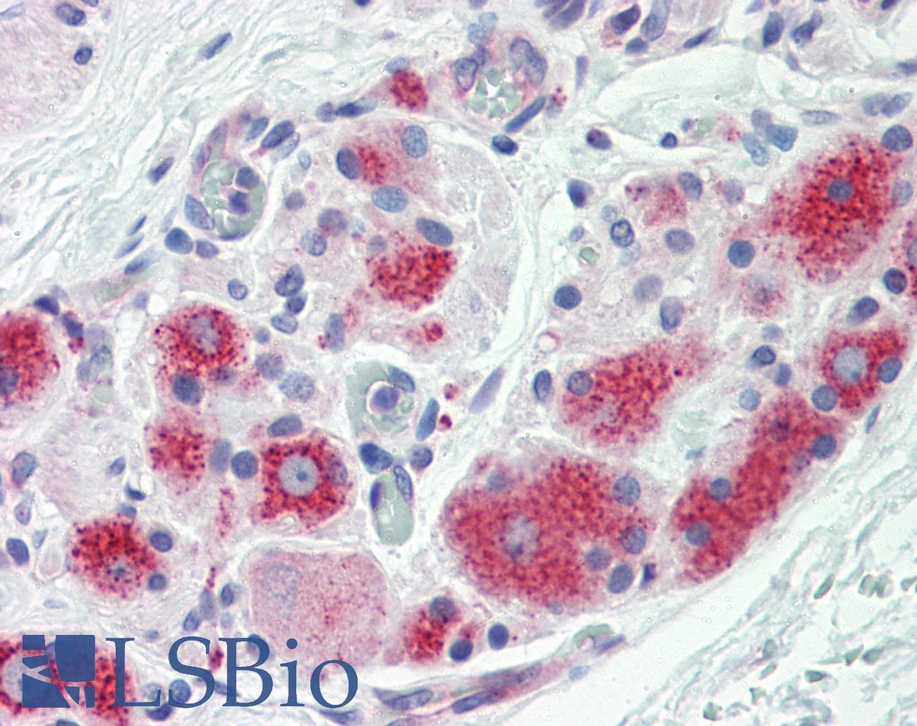 IHC-plus™ PFDN1 Antibody (aa1-50)