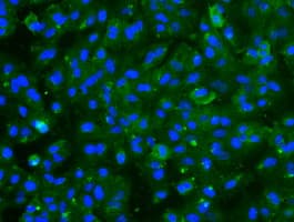 TNNI3 / Cardiac Troponin I Antibody (clone OTI4E5)