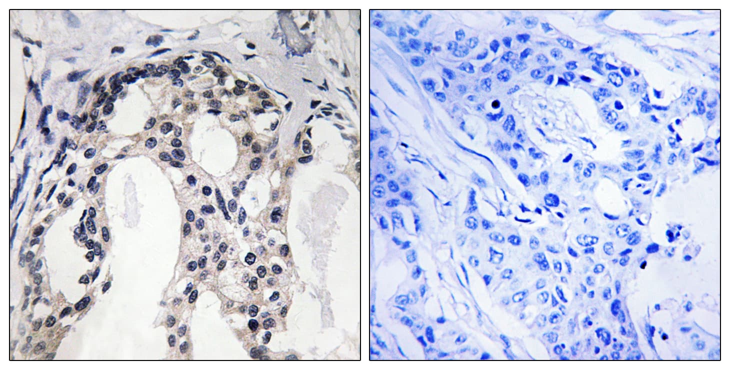 Polyclonal Rabbit anti-Human NF2 / Merlin Antibody (phospho-Ser10, IHC, WB)