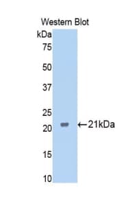 FTMT / MTF Antibody (aa65-227)