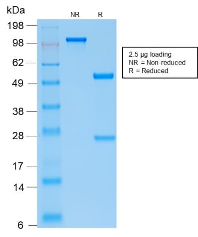 PathPlus™ PTH / Parathyroid Hormone Antibody (clone PTH/2295R)