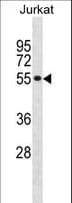 SF3A2 / SF3a66 Antibody (aa166-194)