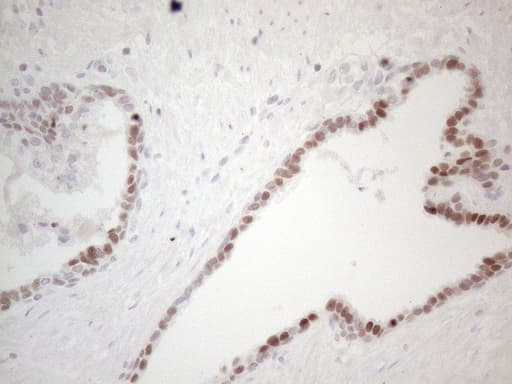 GATA3 Antibody (aa155-443, clone UMAB218)