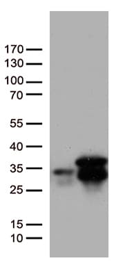 Monoclonal Mouse anti-Human MGMT Antibody (clone UMAB52, IHC, IF, WB)