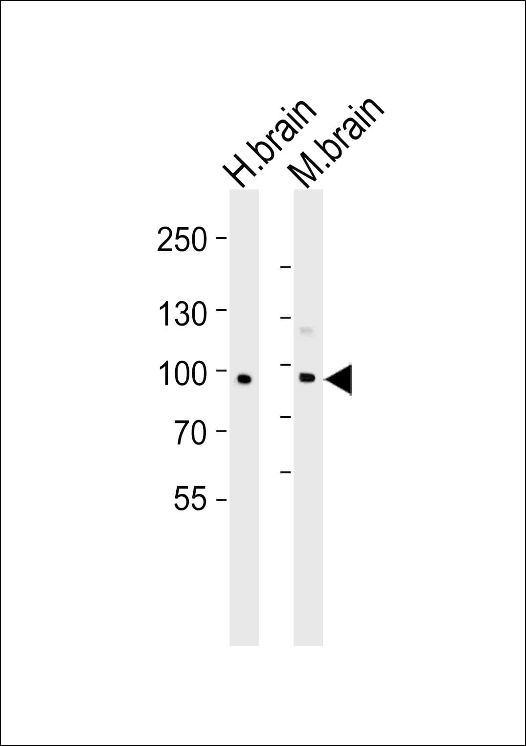 CDH20 / Cadherin 20 Antibody (aa111-140)