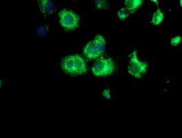 Paraplegin / SPG7 Antibody (clone OTI1C12)