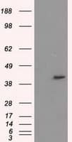 PME-1 / PPME1 Antibody (clone OTI6H5)