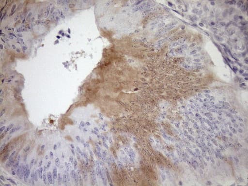 p16INK4a / CDKN2A Antibody (clone OTI7A6)
