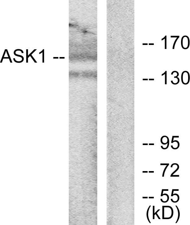 MAP3K5 / ASK1 Antibody (p966)