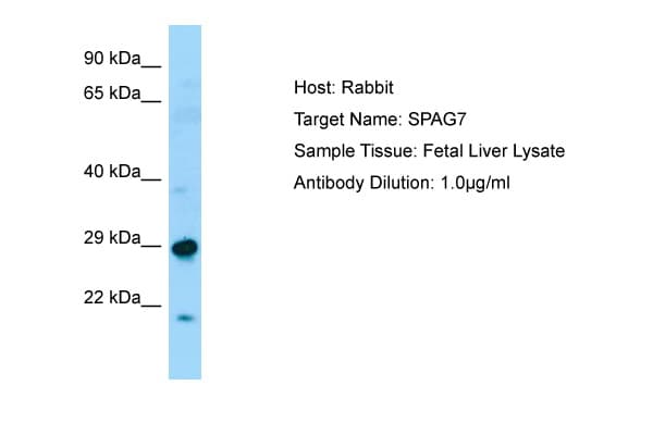Polyclonal Rabbit anti-Human ACRP / SPAG7 Antibody (N-Terminus, WB)