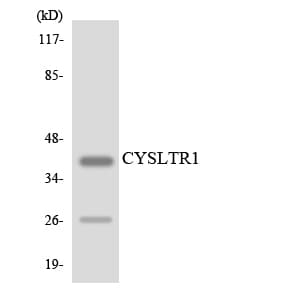 CYSLTR1 / CYSLT1 Antibody (aa124-173)