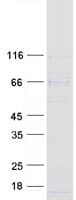 Human WDTC1 Protein (Recombinant Myc-DDK (Flag))