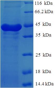 Human CAPNS1 / CAPN4 Protein (Recombinant His-SUMO)