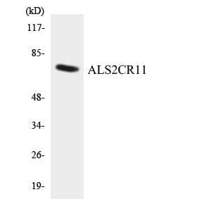 ALS2CR11 Antibody (aa473-522)