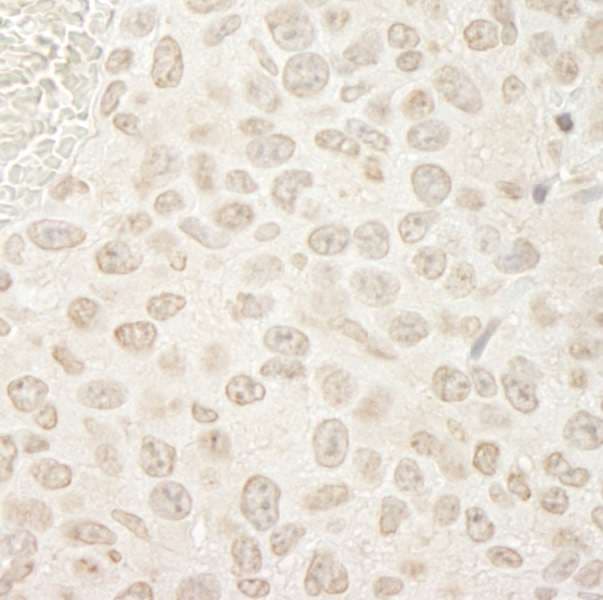 Polyclonal Rabbit anti-Human PPP3CA / CCN1 / Calcineurin A Antibody (aa470-C-term, IHC)