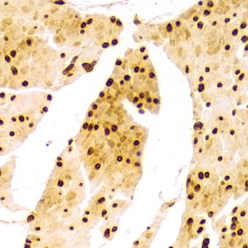 LMNA / Lamin A+C Antibody