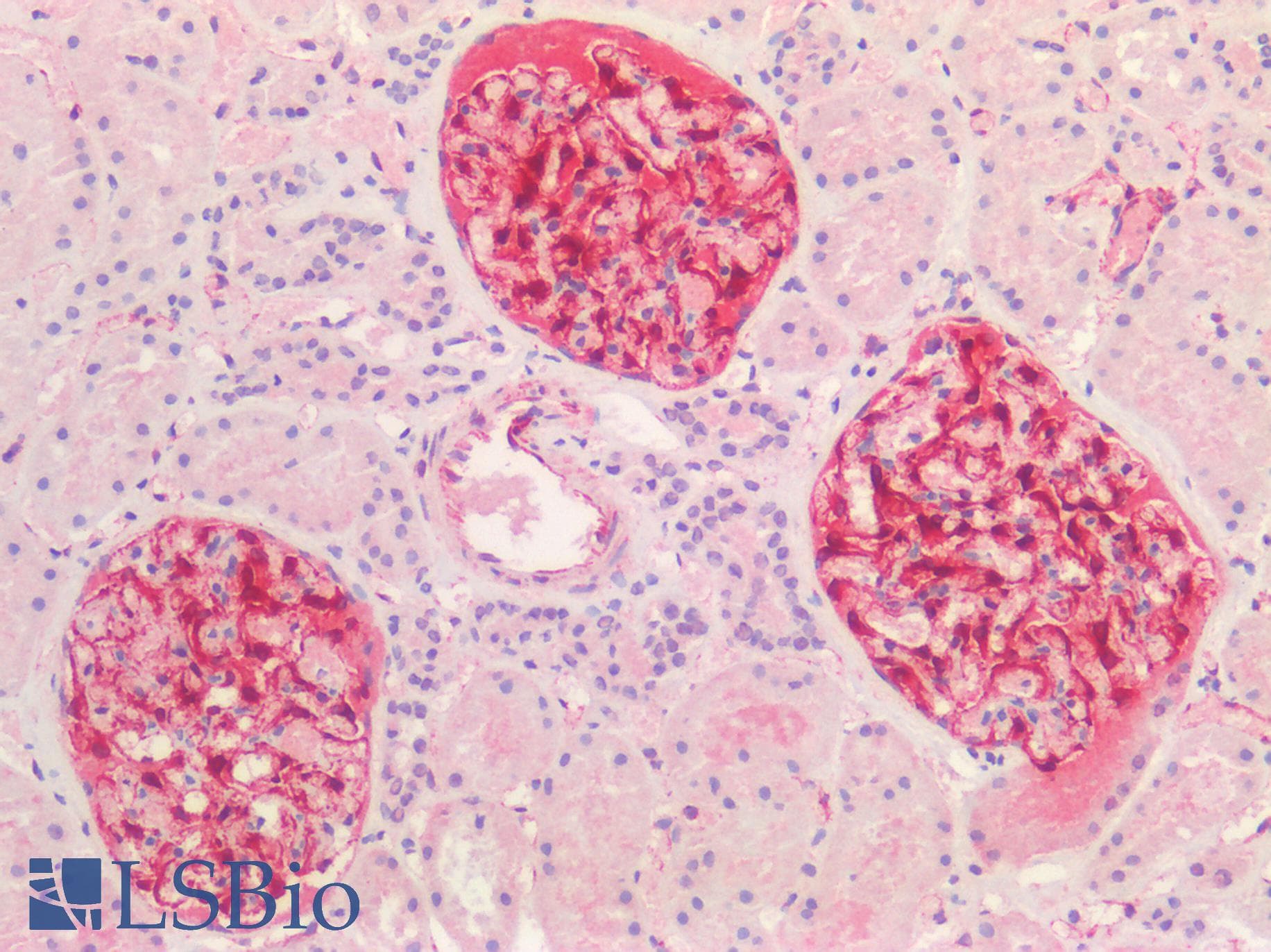 PathPlus™ NES / Nestin Antibody