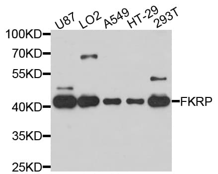 Polyclonal Rabbit anti-Human FKRP Antibody (WB)