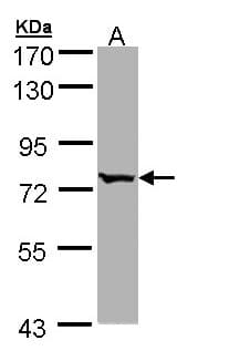 Polyclonal Rabbit anti-Human BBS10 Antibody (aa182-443, IHC, WB)