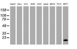 Monoclonal Mouse anti-Human FXYD3 Antibody (clone OTI1E8, IHC, IF, WB)