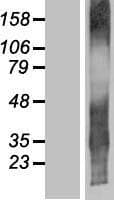 TMEM107 Protein (Over-Expression Lysate Myc-DDK (Flag))