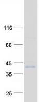 Human ZDHHC15 Protein (Recombinant Myc-DDK (Flag))