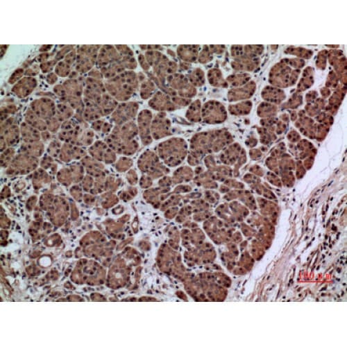 Alpha-1-Antichymotrypsin Antibody (251-300 aa, Internal)