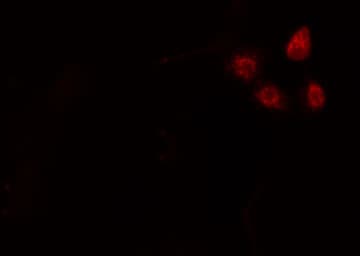 Polyclonal Rabbit anti-Human NFYA Antibody (IF, WB)