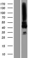 MAGEA3 Protein (Over-Expression Lysate Myc-DDK (Flag))