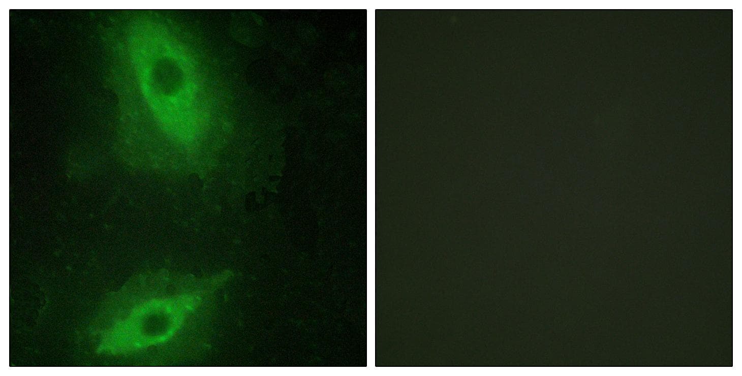 TNFSF15 / TL1A / VEGI Antibody
