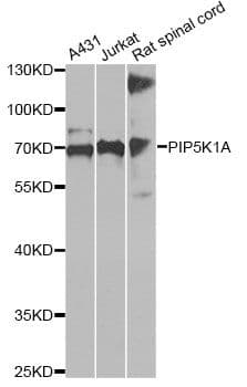 PIP5K1A Antibody
