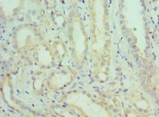 SEMG1 Antibody (aa24-310)