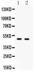 Polyclonal Rabbit anti-Human E2F3 Antibody (aa446-465, WB)