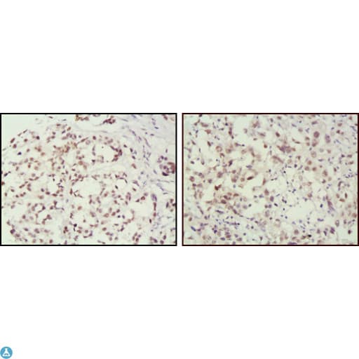 MSH2 Antibody