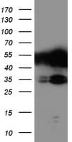TAL1 Antibody (clone OTI5A5)