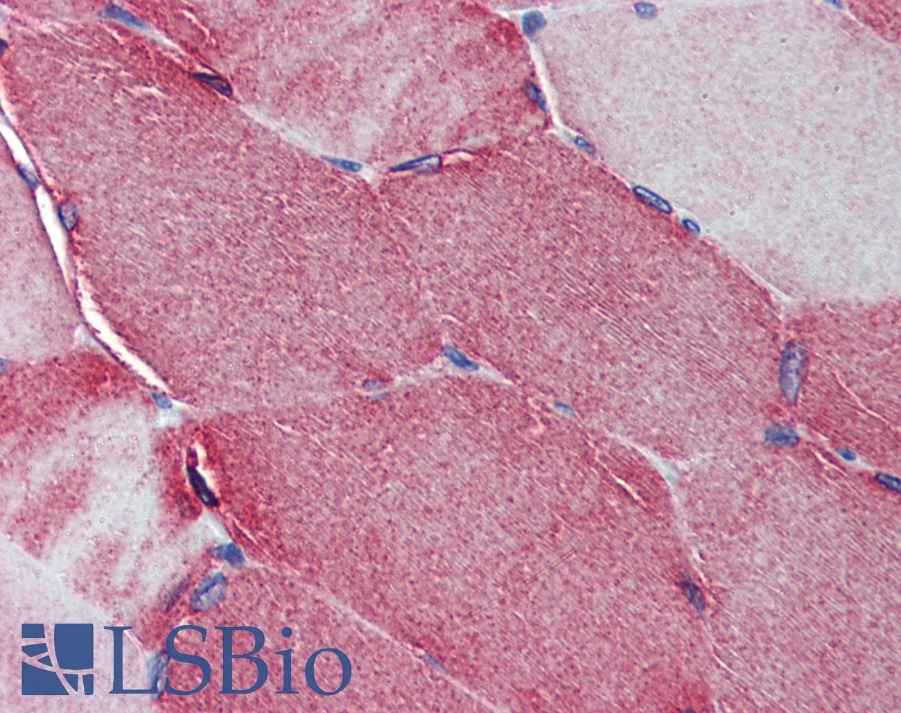 IHC-plus™ Junctophilin 2 / JPH2 Antibody