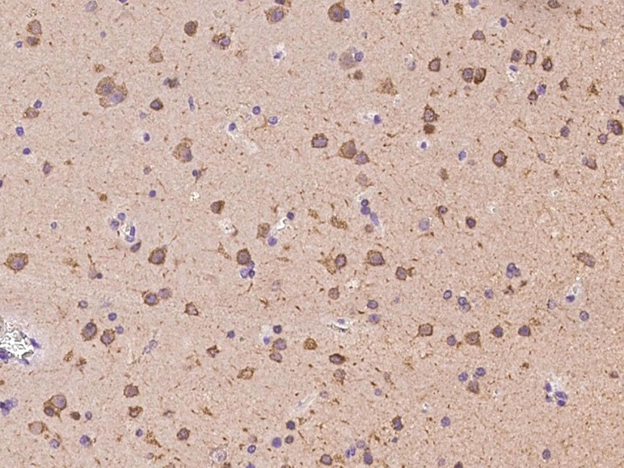 PTK2B / PYK2 Antibody (Preservative Free)