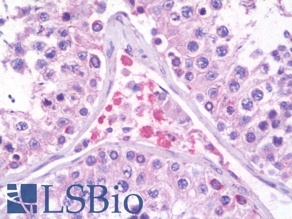 IHC-plus™ PRICKLE2 Antibody