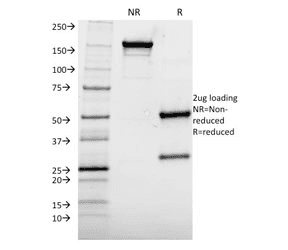 Monoclonal Mouse anti-Human AKT1 Antibody (clone AKT1/2552, IHC)