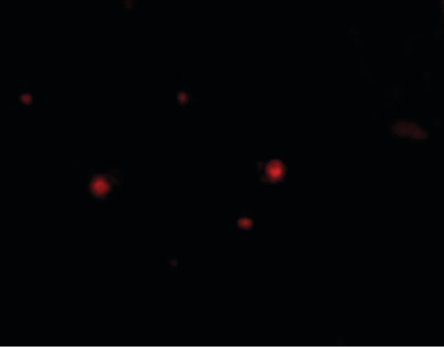 STIM2 Antibody