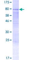 Human AMOTL2 Protein (Recombinant GST)
