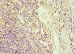 Polyclonal Rabbit anti-Human GRN / Granulin Antibody (aa20-310, IHC)