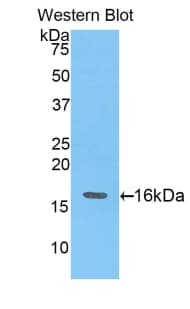 Angiogenin / ANG Antibody (aa25-145)