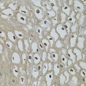 IL-33 Antibody